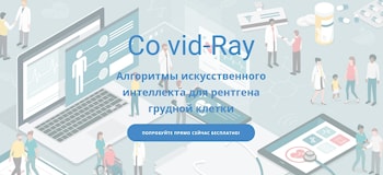 Белорусский стартап научился выявлять бессимптомную пневмонию